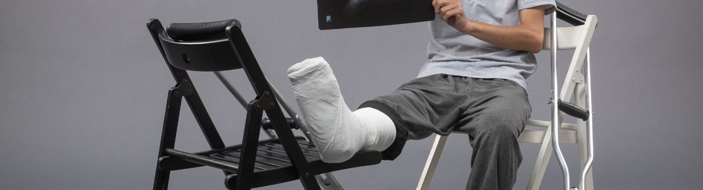 Oblique Fracture - Causes, Symptoms, Diagnosis, Treatment, and Prevention