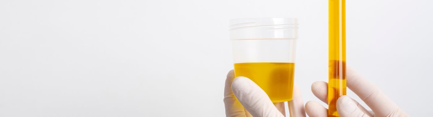 Orthostatic Proteinuria - Causes, Symptoms, Diagnosis, Treatment, and Prevention