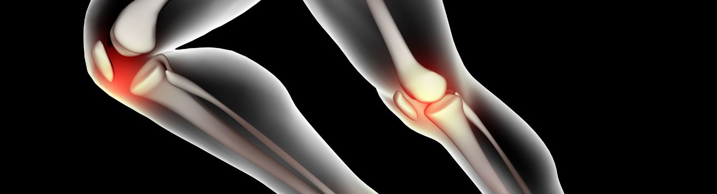 Osteopoikilosis - Causes, Symptoms, Diagnosis, Treatment, and Prevention