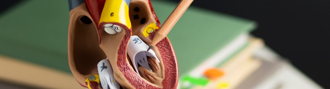 Overriding Aorta - Causes, Symptoms, Diagnosis, Treatment, and Prevention