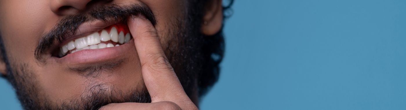 Periodontal Abscess - Causes, Symptoms, Diagnosis, Treatment, and Prevention