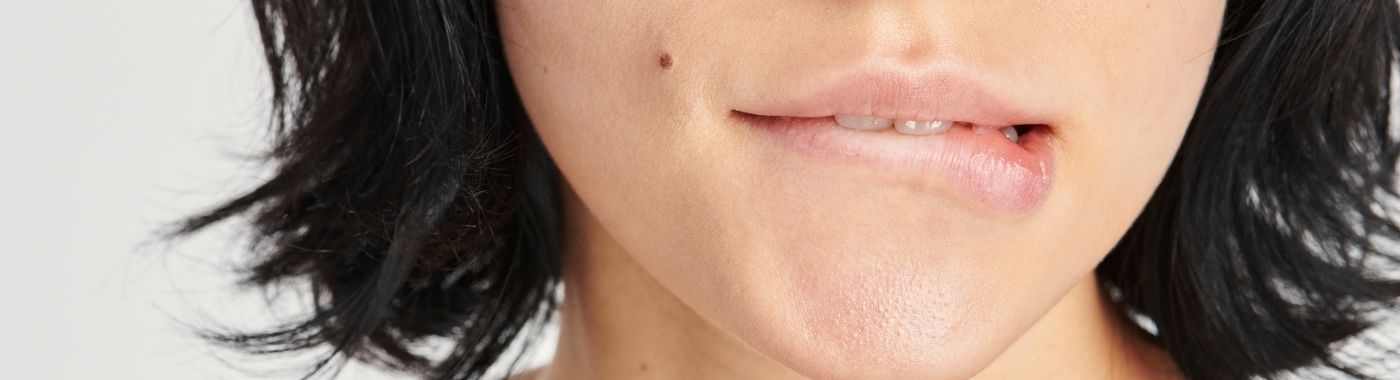 Perioral Dermatitis - Causes, Symptoms, Diagnosis, Treatment, and Prevention