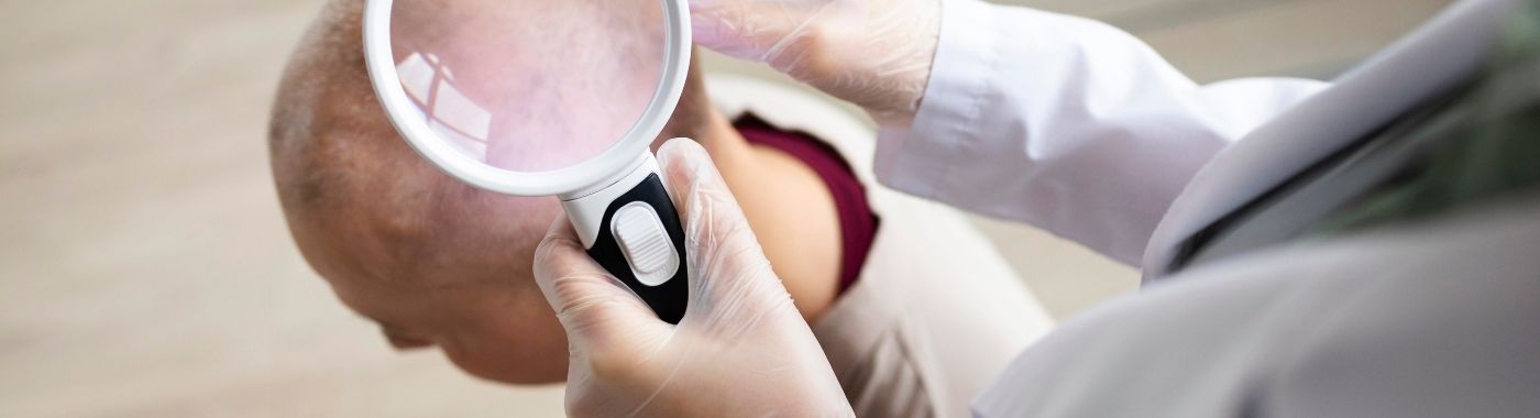 Pitted Keratolysis - Causes, Symptoms, Diagnosis, Treatment, and Prevention