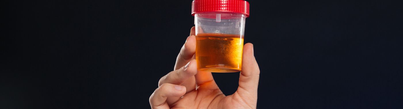 Pyuria - Causes, Symptoms, Diagnosis, Treatment, and Prevention