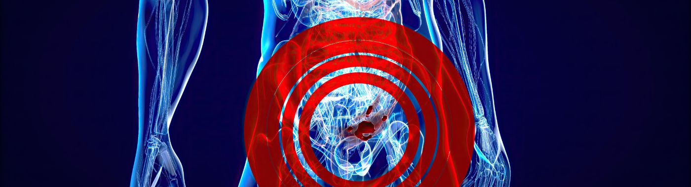 Renal Angiomyolipoma - Causes, Symptoms, Diagnosis, Treatment, and Prevention