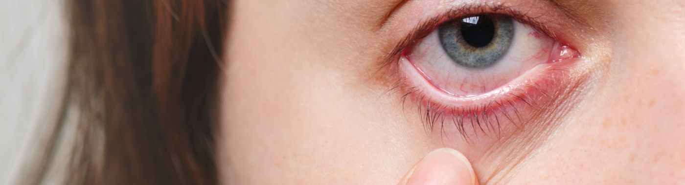 Retinoblastoma - Early Signs, Risk Factors, Diagnosis, and Treatment Explained