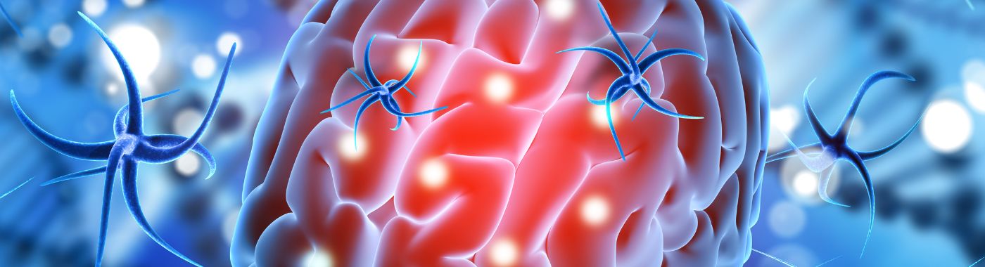 Schwannoma - Causes, Symptoms, Diagnosis, Treatment, and Prevention