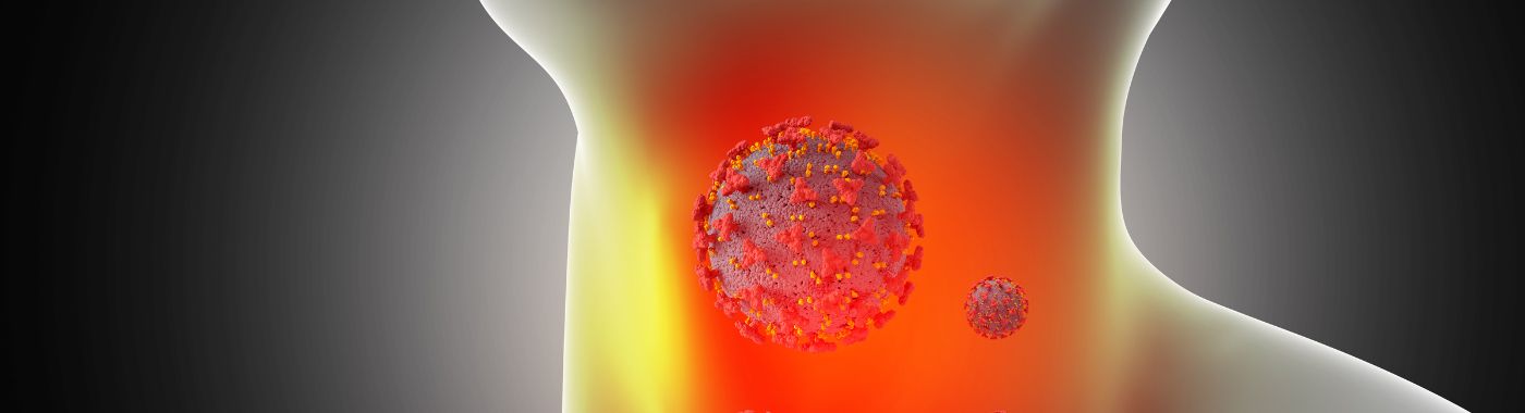 Scrofula - Causes, Symptoms, Diagnosis, Treatment, and Prevention