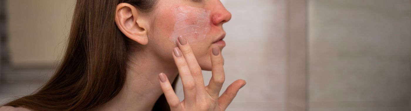 Sebaceous Hyperplasia - Causes, Symptoms, Diagnosis, Treatment, and Prevention