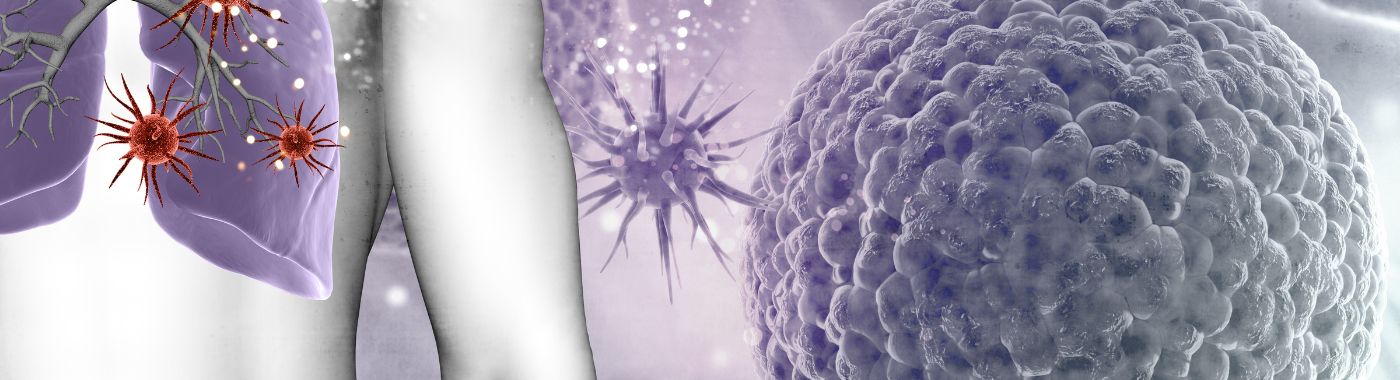 Silicosis - Causes, Symptoms, Diagnosis, Treatment, and Prevention