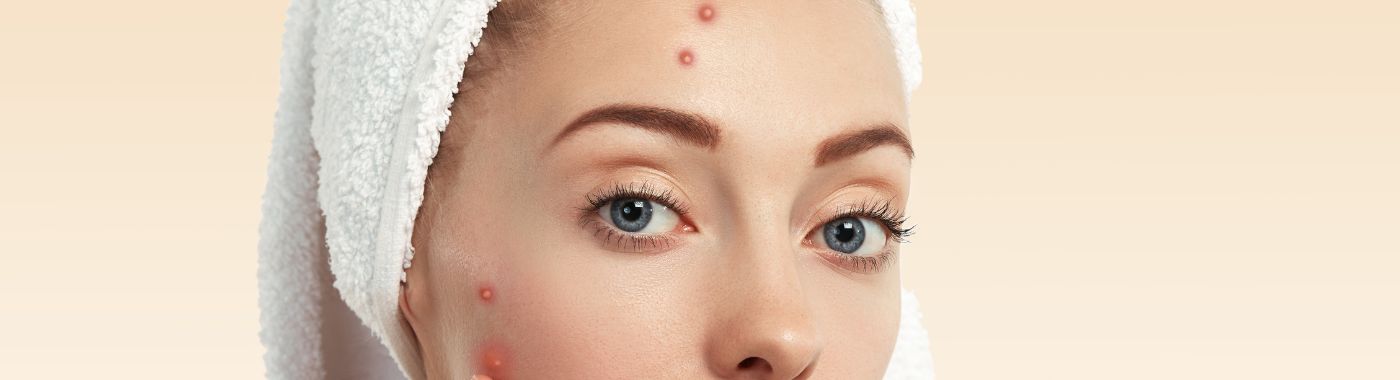 Spitz Nevus - Causes, Symptoms, Diagnosis, Treatment, and Prevention