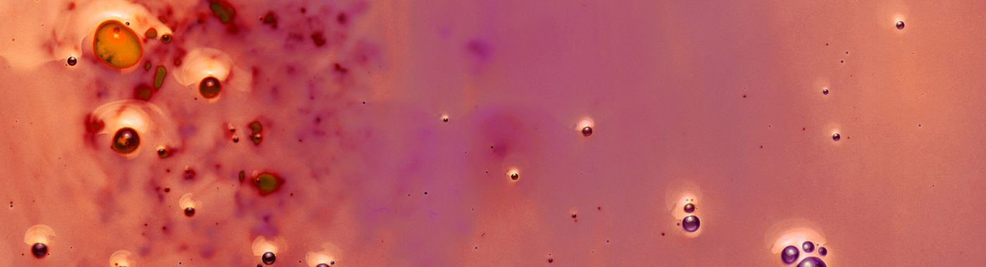 Squamous Metaplasia - Causes, Symptoms, Diagnosis, Treatment, and Prevention