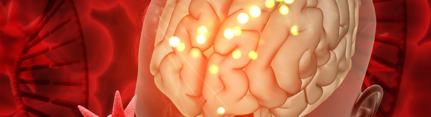 Stroke - Types, Symptoms and Treatment