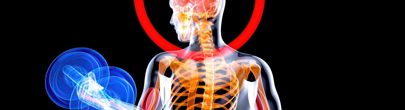 Subclavian Steal Syndrome - Causes, Symptoms, Diagnosis, Treatment, and Prevention