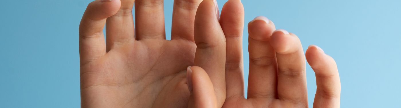 Symbrachydactyly - Causes, Symptoms, Diagnosis, Treatment, and Prevention