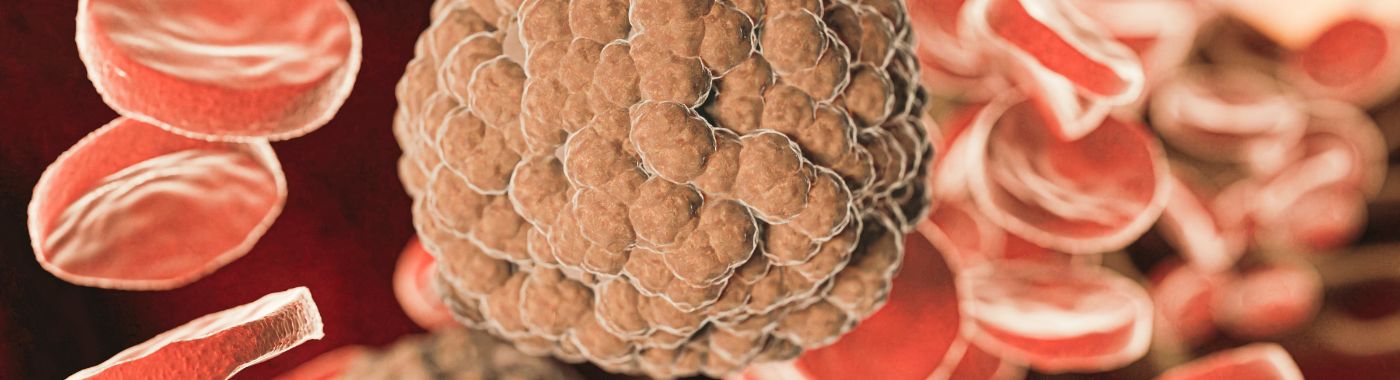 Thrombocytosis - Causes, Symptoms, Diagnosis, Treatment, and Prevention