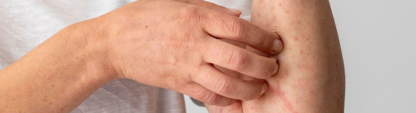 Thrombotic Thrombocytopenic Purpura - Causes, Symptoms, Diagnosis, Treatment, and Prevention