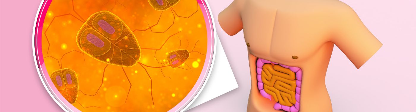Toxic Megacolon - Causes, Symptoms, Diagnosis, Treatment, and Prevention