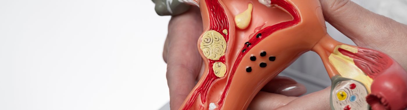 Vaginal Cysts - Causes, Symptoms, Diagnosis, Treatment, and Prevention