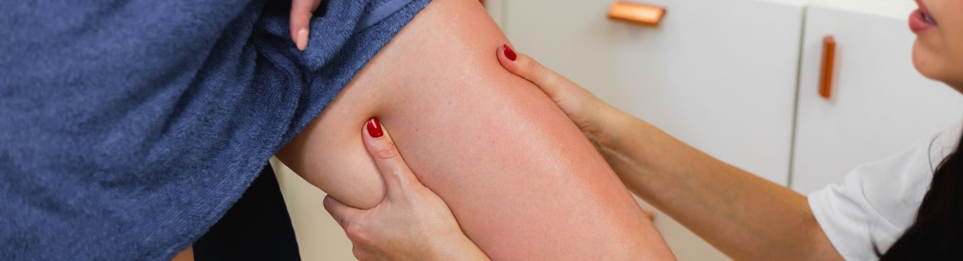 Venous Ulcer - Causes, Symptoms, Diagnosis, Treatment, and Prevention