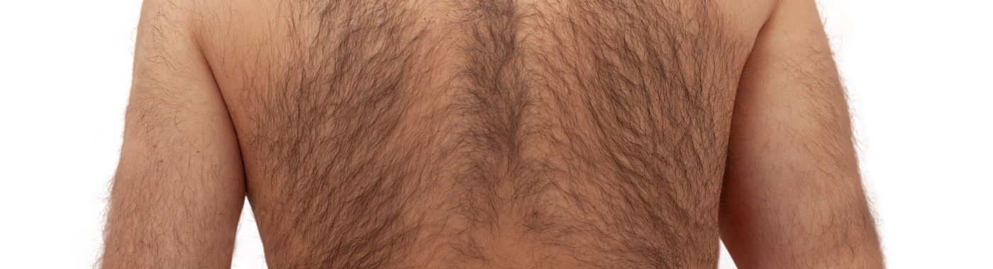 Virilization - Causes, Symptoms, Diagnosis, Treatment, and Prevention