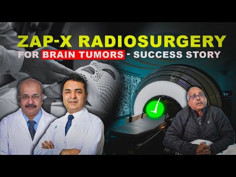  ZAP-X Radiosurgery Procedure for Brain Tumors Success Stories