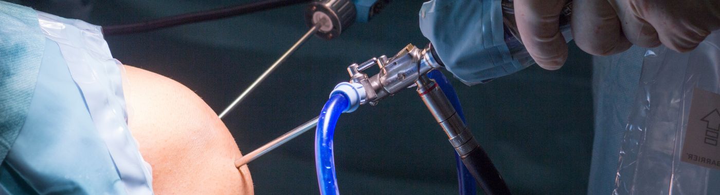 ACL/PCL Reconstruction - Procedures, Preparation, Cost, and Recovery