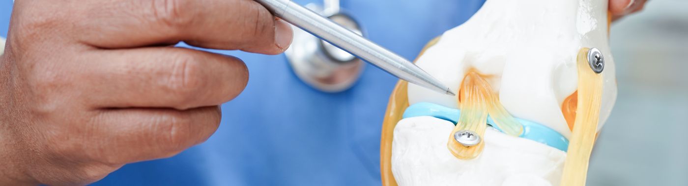 Arthroplasty (Joint Replacement Surgery) Recovery And Side-Effects