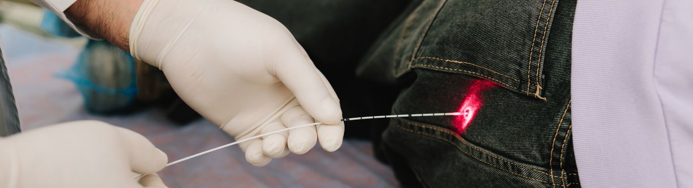 AV Fistula - Procedures, Preparation, Cost, and Recovery