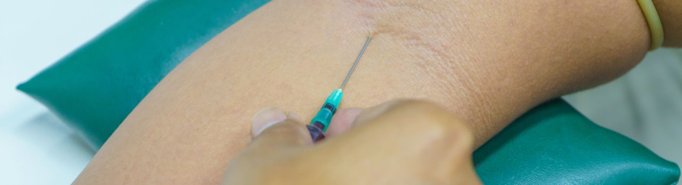 Central Venous Catheterization (CVC) - Procedures, Preparation, Cost, and Recovery