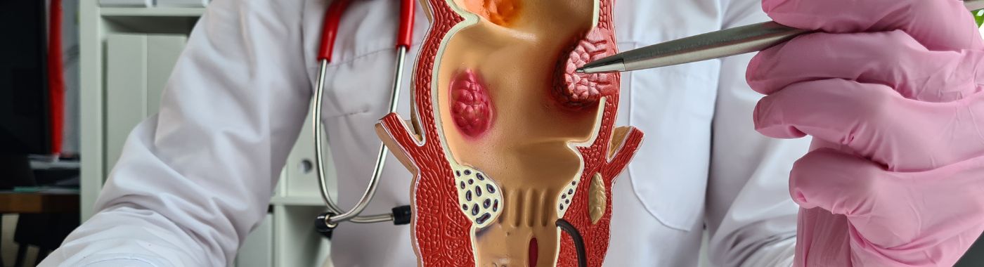 Cystectomy (Bladder Removal Surgery) - Procedures, Preparation, Cost, and Recovery