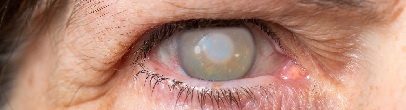 eye-miosis