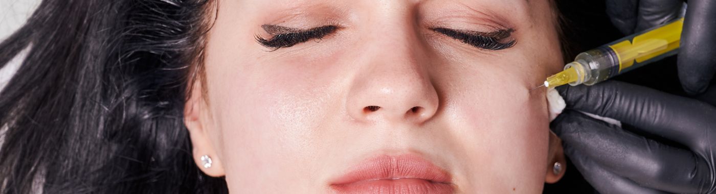 Facial Fillers for Wrinkles