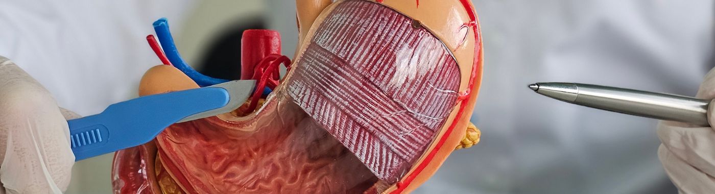 Gastrektomie - Prosedures, Voorbereiding, Koste en Herstel