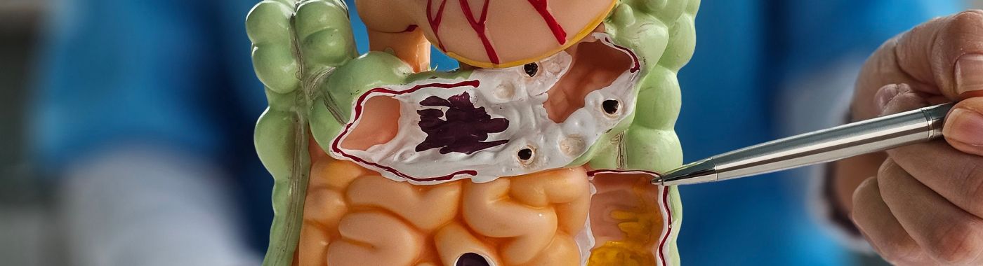 Intestine Transplant - Procedures, Preparation, Cost, and Recovery