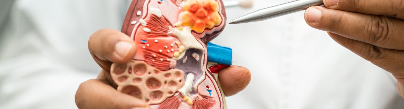 Kidney Biopsy - Procedures, Preparation, Cost, and Recovery