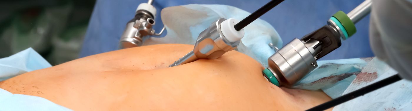 Laparoscopic Surgery - Procedures, Preparation, Cost, and Recovery