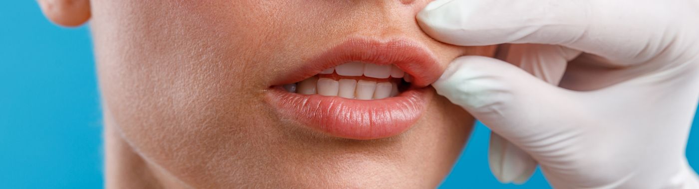 Cirurgia Labial - Procedimentos, Preparação, Custo e Recuperação