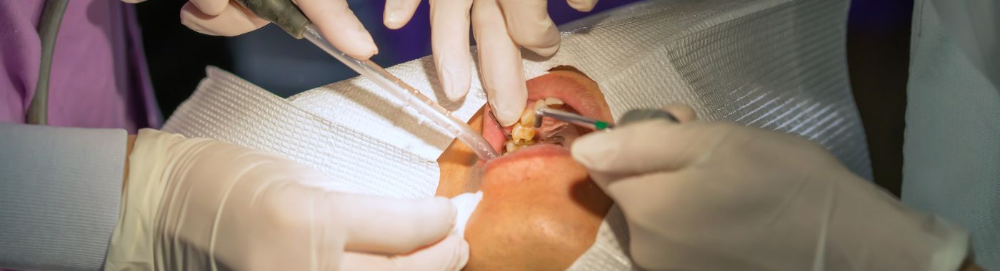 Marsupializasyon - Prosedürler, Hazırlık, Maliyet ve Kurtarma