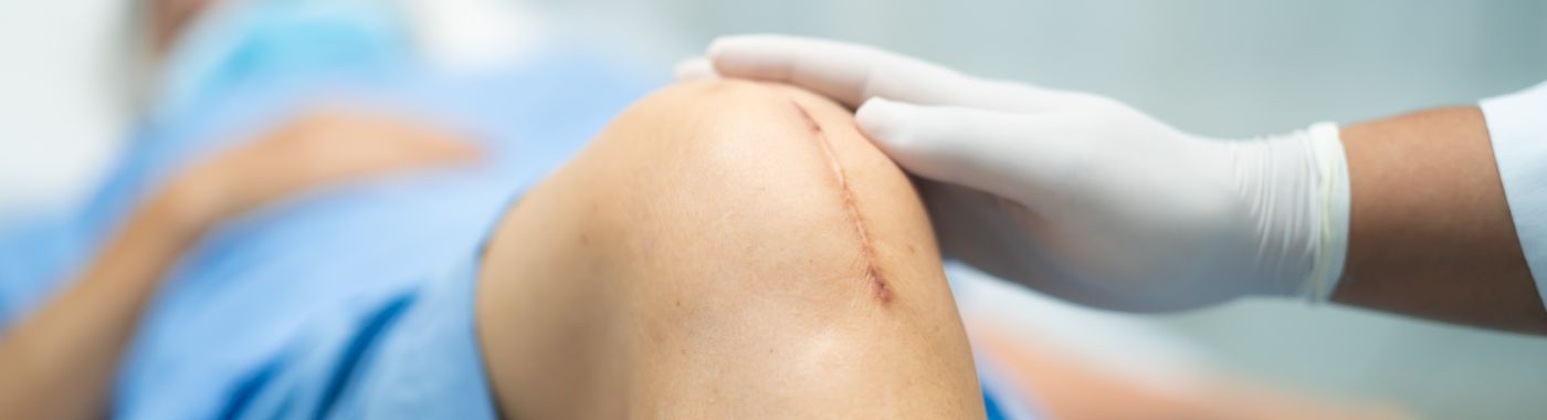 Minimally Invasive Subvastus Total Knee Replacement - Procedures, Preparation, Cost, and Recovery