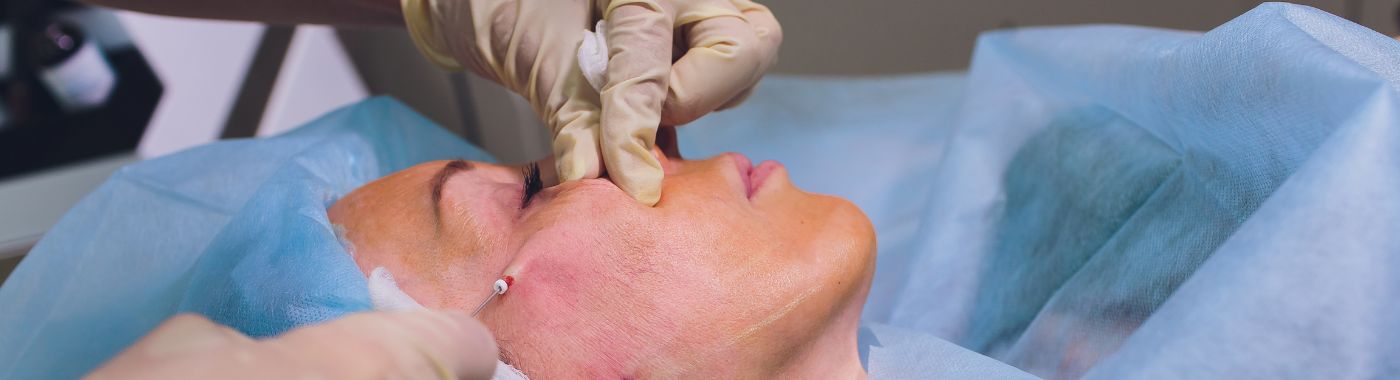 Mohs Surgery - Procedures, Preparation, Cost, and Recovery