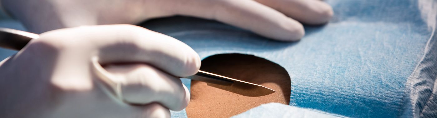 Orchiectomy/Orchidectomy- Types, Procedure, Cost in India, Risks, Recovery and benefits