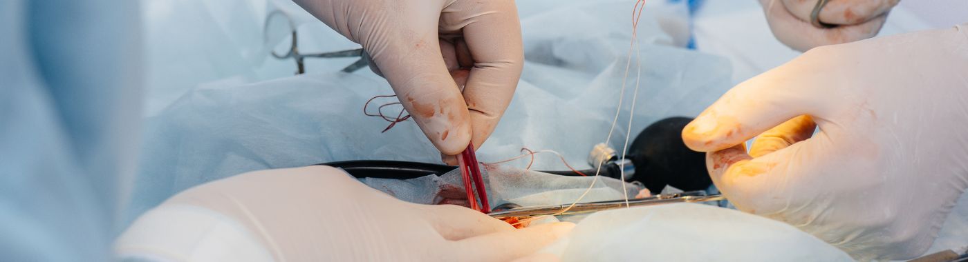 Orchiopexy- Types, Procedure, Cost in India, Risks, Recovery and benefits