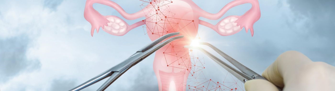 Ovarian Cancer Surgery- Procedure, Cost in India, Risks, Recovery and benefits