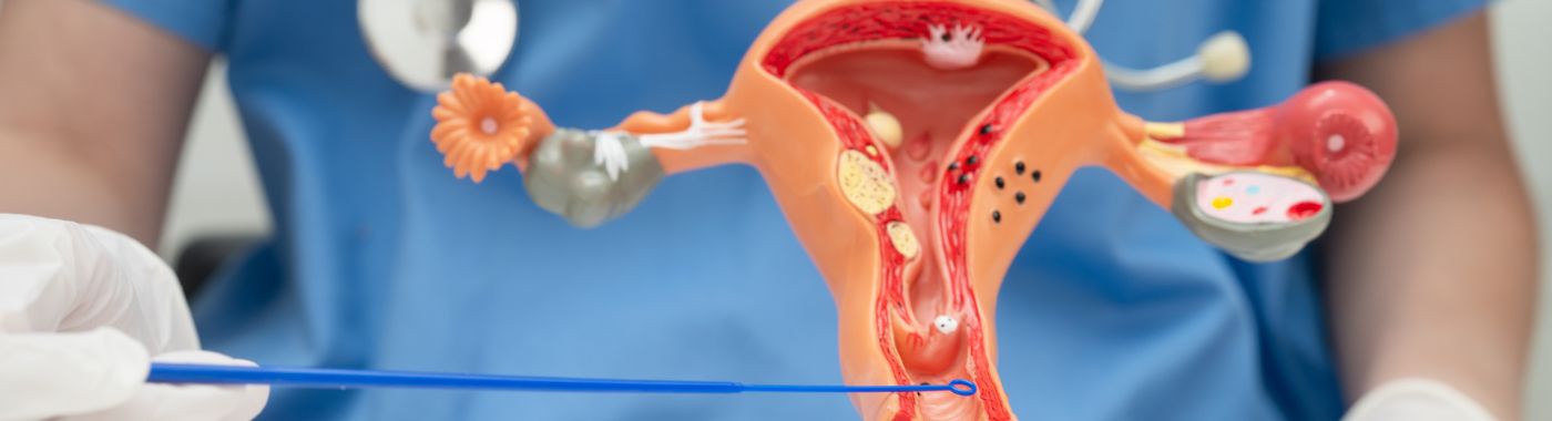 Ovarian Cystectomy- Types, Procedure, Cost in India, Risks, Recovery and benefits