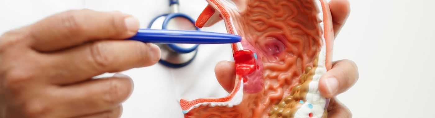 Paraesophageal Hernia Repair- Types, Procedure, Cost in India, Risks, Recovery and benefits