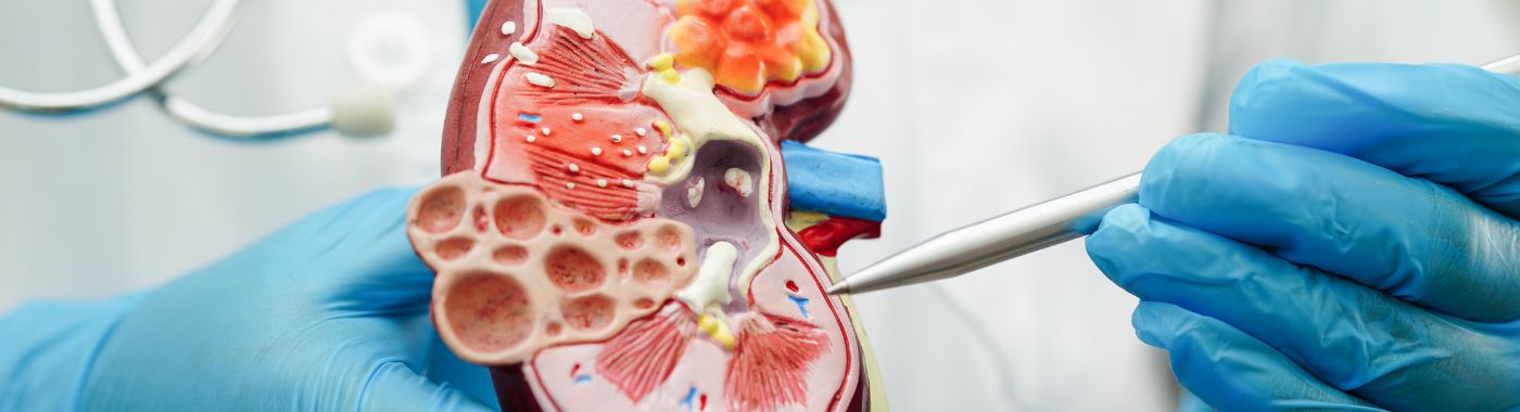 Partial Nephrectomy- Types, Procedure, Cost in India, Risks, Recovery and benefits