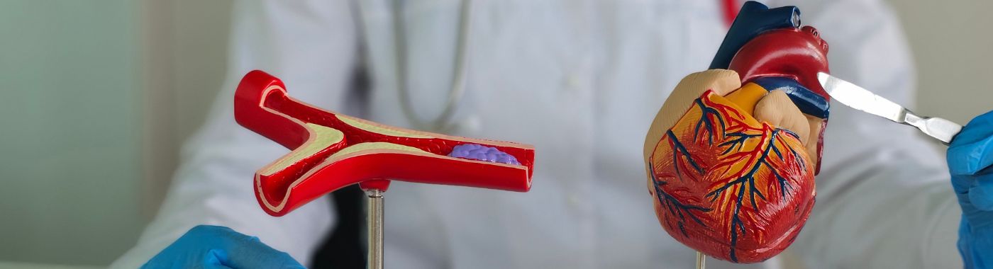 Percutaneous Coronary Intervention - Procedures, Preparation, Cost, and Recovery