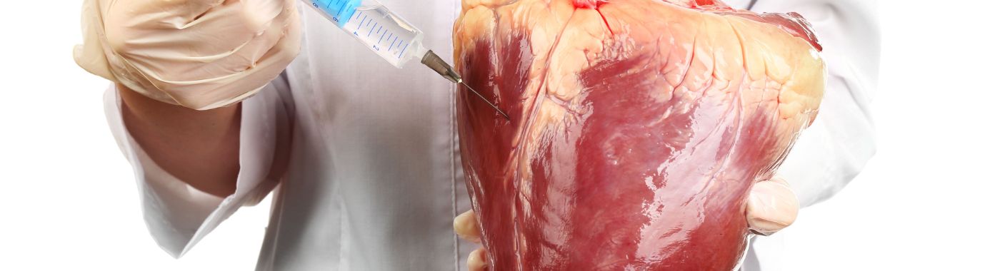 Pericardiocentesis – Procedure, Purpose, and Results