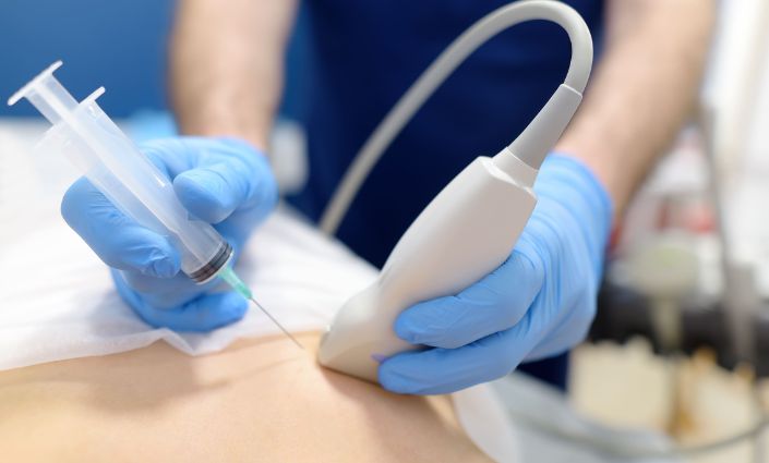 New Procedure Image Therapeutic Procedure